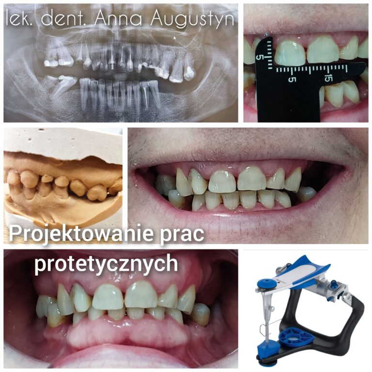 Plan protetyczny Krapkowice