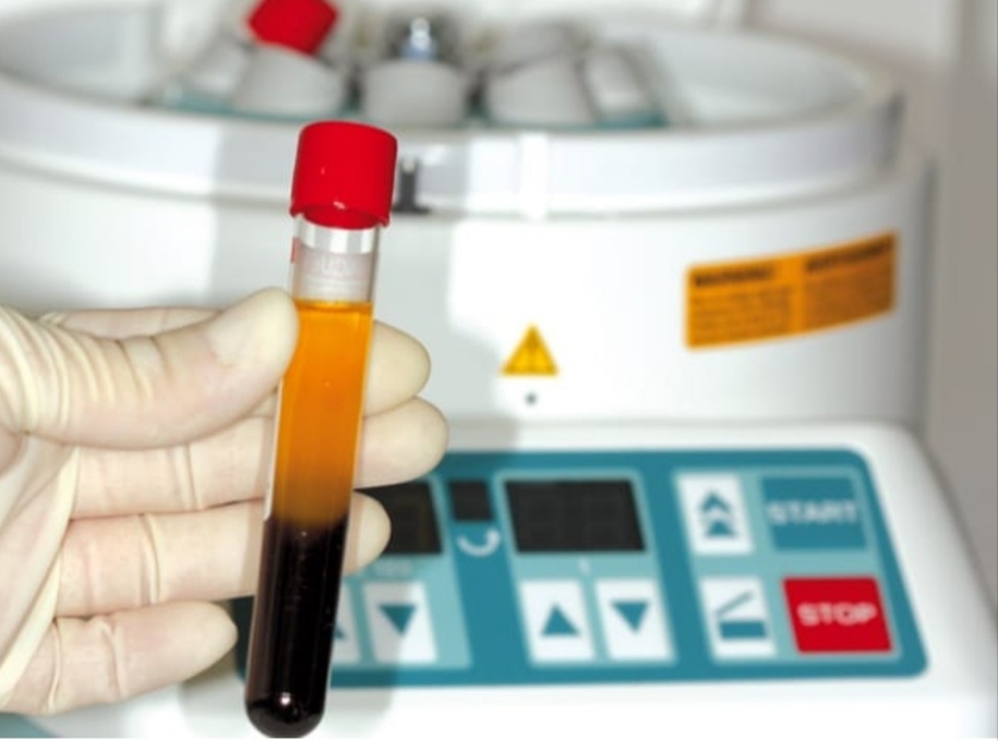 PRF - fibryna bogatopłytkowa Krapkowice