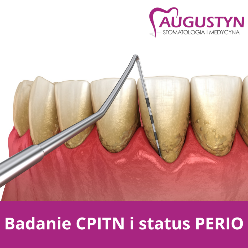 Badanie CPITN i status PERIO