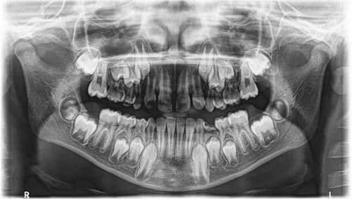 ortodoncja Krapkowice