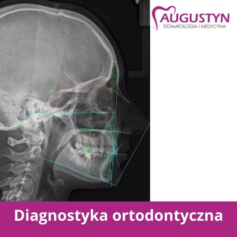 konsultacja ortodontyczna