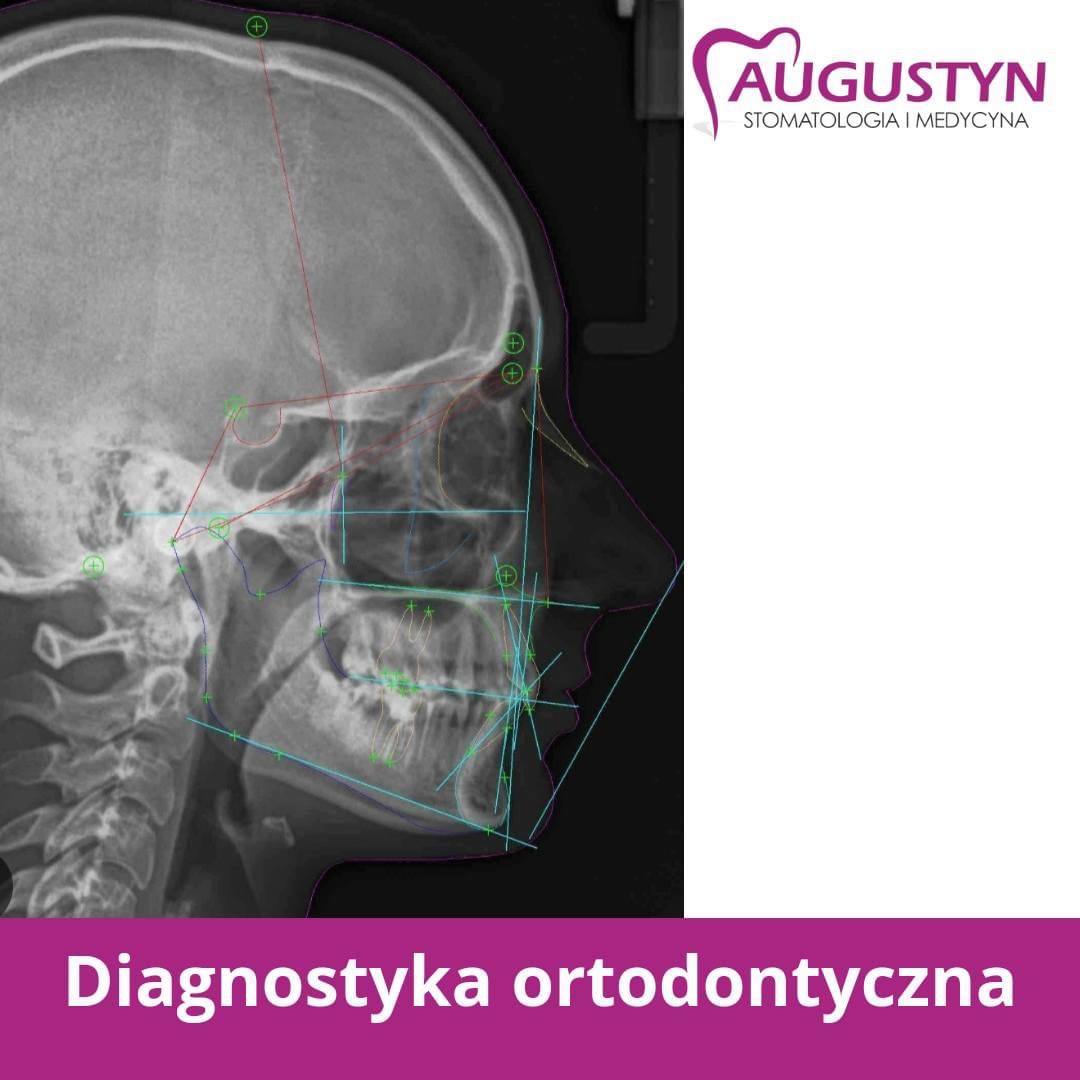 konsultacja ortodontyczna