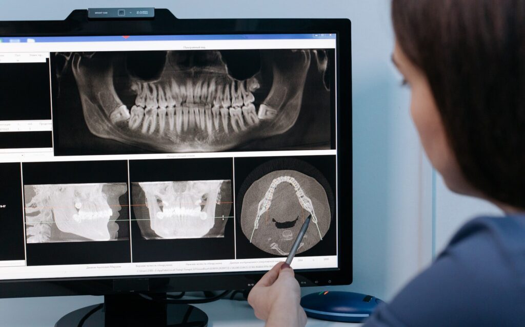 zdjęcie rentgenowskie