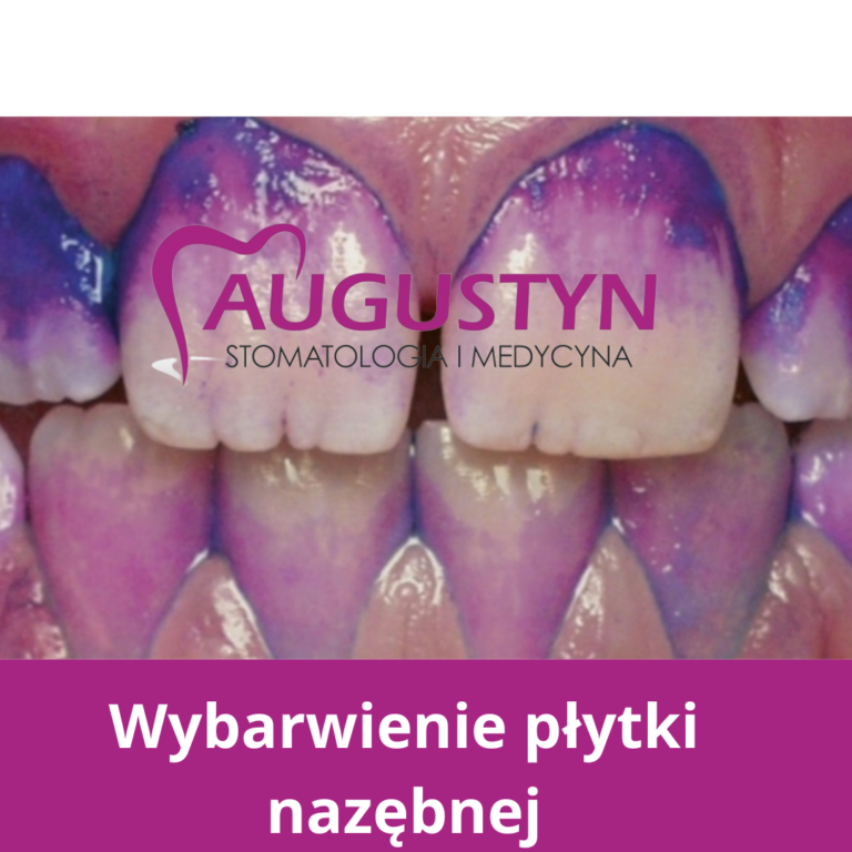Piaskowanie zębów – skuteczny sposób na zdrowy uśmiech
