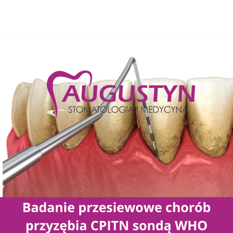 PERIODONTOLOGIA – klucz do zdrowych dziąseł