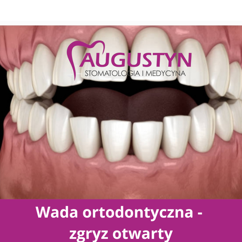 Edukacja - ortodoncja