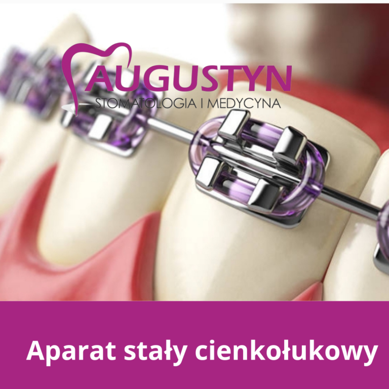 Mikroimplanty w ortodoncji