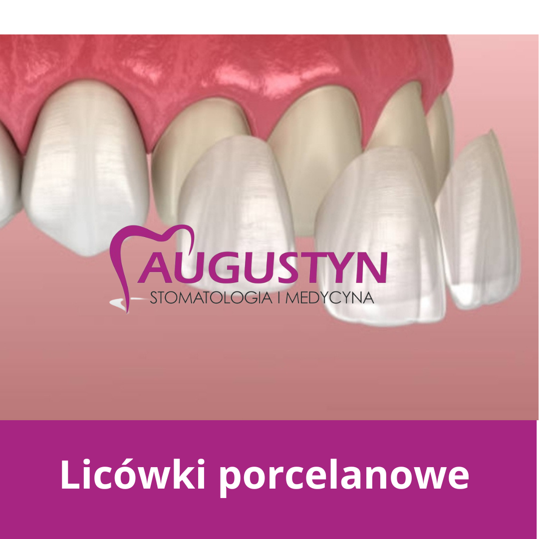 Edukacja – protetyka