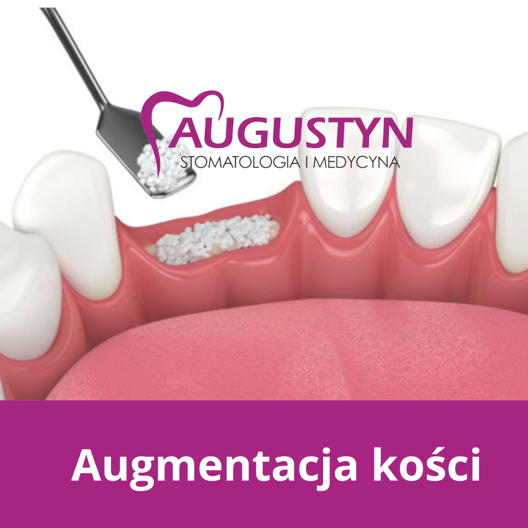 Edukacja - implantologia