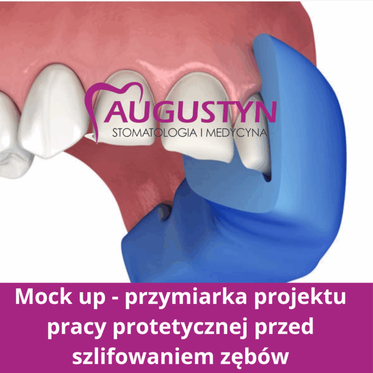 Wyciski i skany w stomatologii – nowoczesna diagnostyka i precyzyjne planowanie leczenia