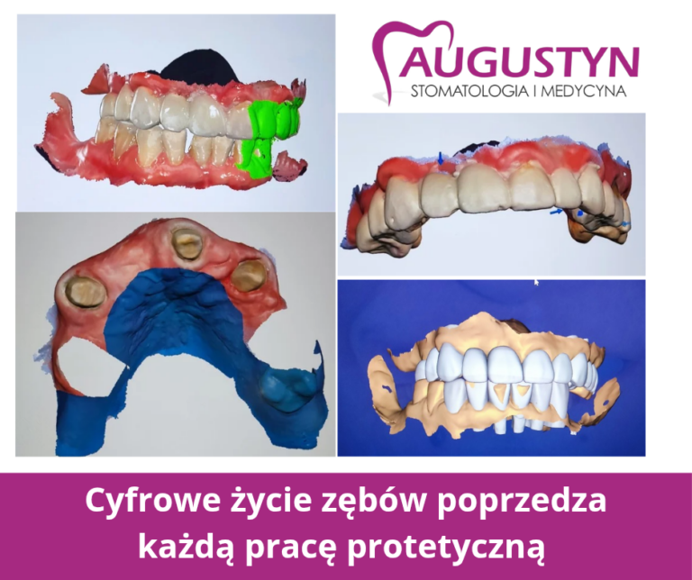 Cyfrowa stomatologia