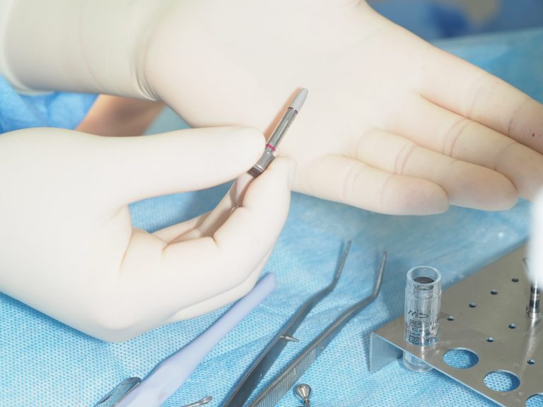 Implanty stomatologiczne – trwały sposób na odbudowę utraconych zębów